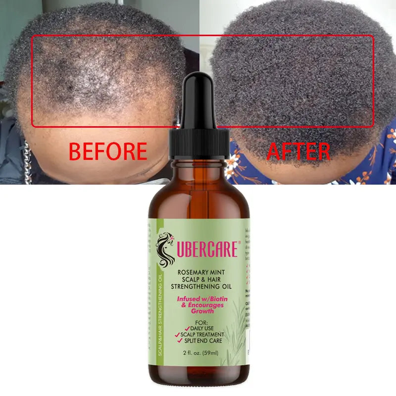 Mielle Rosemary Hair Strengthening Oil